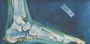 x-ray, foot